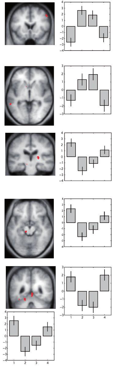 734 Brain 2010: 133; 727 745 M. Jahanshahi et al. A y = 16 middle frontal gyrus continuation tasks separately and whether this was manifest as an increase or decrease in timing-related activity.