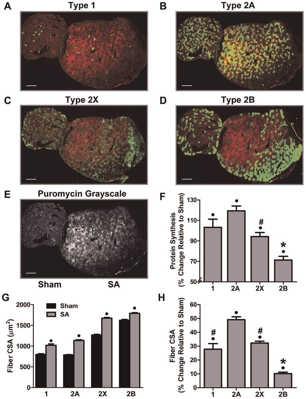 Figure 2. Synergist Ablation Induces Fiber Type-Dependent Changes in Protein Synthesis and Cross-Sectional Area.