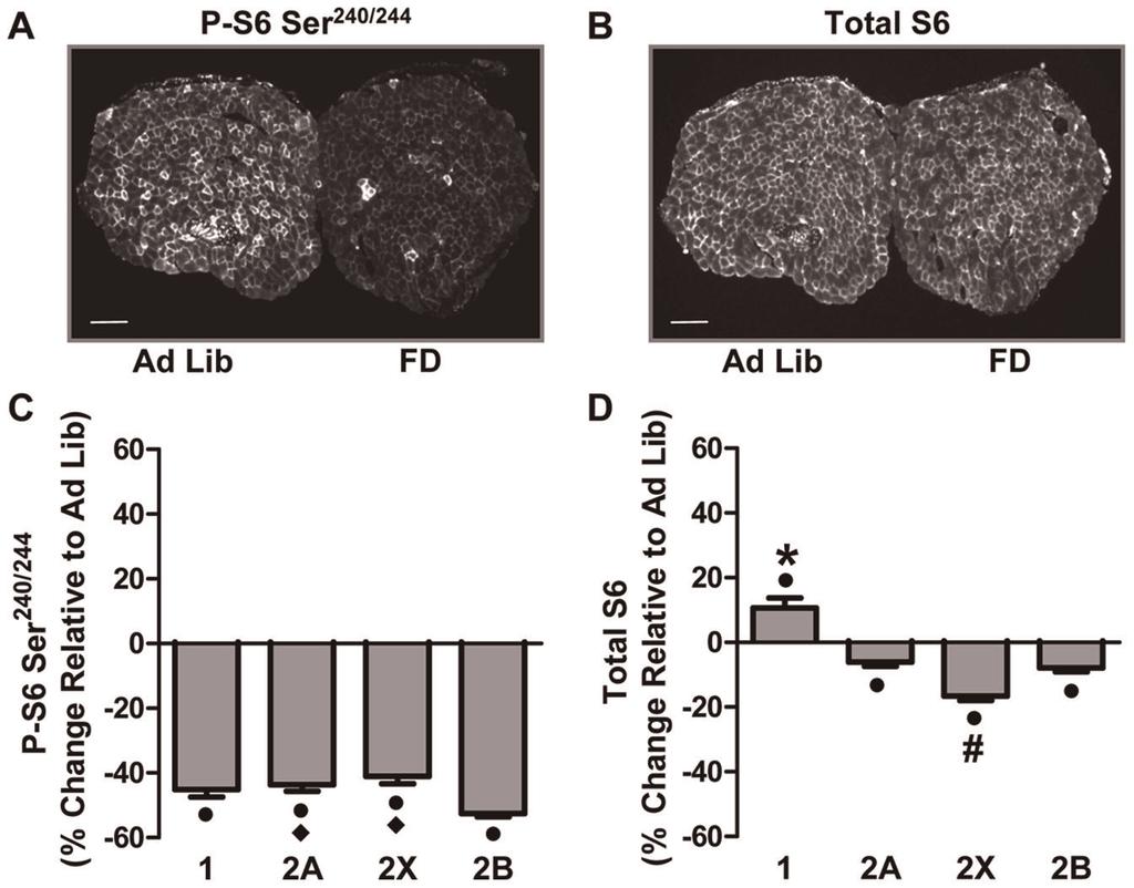 Figure 3. Food Deprivation Induces Fiber Type-Dependent Changes in Ser 240/244 Phosphorylated and Total Ribosomal S6 Protein.