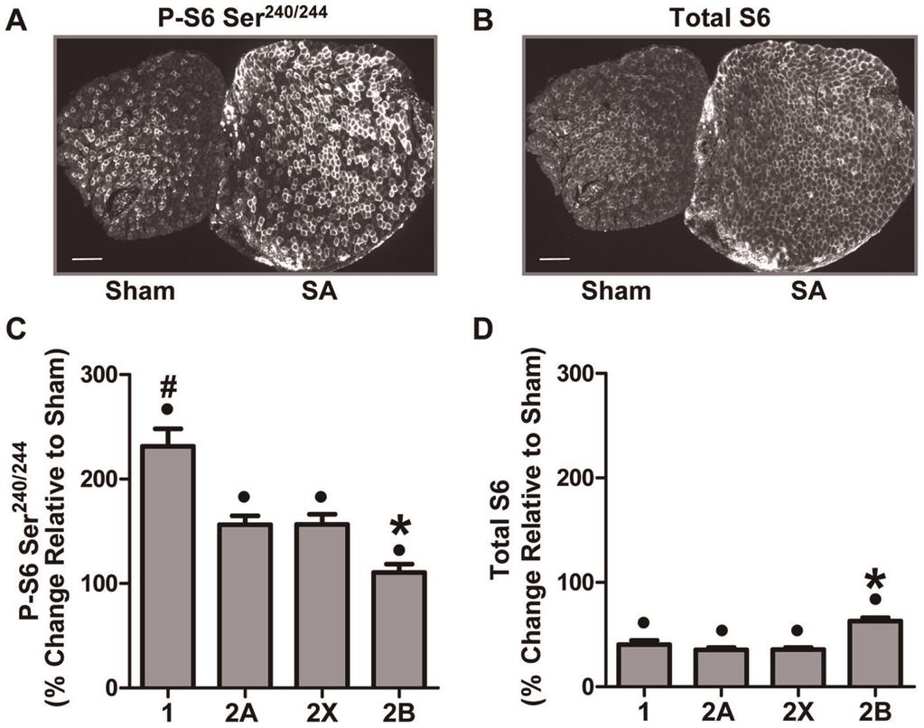 Figure 4. Synergist Ablation Induces Fiber Type-Dependent Changes in Ser 240/244 Phosphorylated and Total Ribosomal S6 Protein.