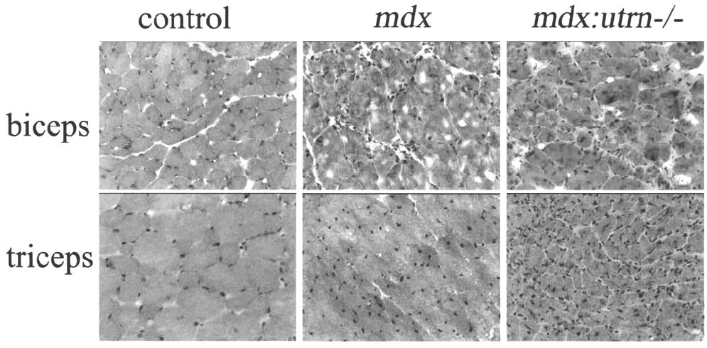 Figure 4.1 Muscle sections from dystrophic and control 24 week old mice stained by H&E (hematoxylin and eosin) 57. Reprinted from Neuromuscular Disorders (Connolly, A.M., et al.