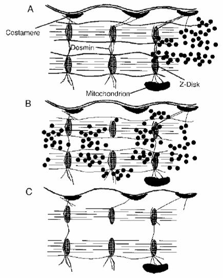 Figure 4.2 Diagram showing damage caused by eccentric contraction. The solid dots represent calcium ions. (A) Muscle fiber strain results in an increased intracellular calcium ion.