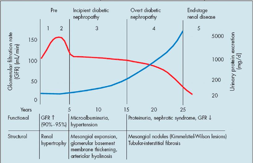 Natural History of T2DM and Risk for Complications Post-meal glucose Fasting glucose PG 200 mg/dl PG 126 mg/dl Meets ADA diagnostic criteria for T2DM Macrovascular disease risk Other risk e.g. cancer; NAFLD Microvascular disease risk Insulin Resistance Beta-cell Function DeFronzo R.