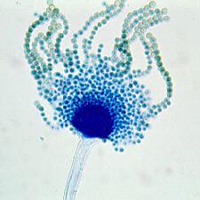 Aflatoxins: scope of the problem Produced by Aspergillus flavus, A.
