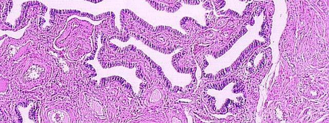 complexed with the ovary Unique region-large surface area and exposed to biological events
