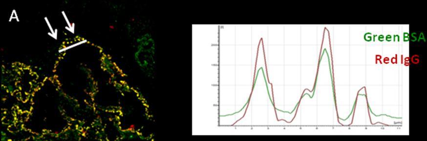 Figure 3 Supplement Colocalization of BSA and IgG in immune deposits: quantitative analysis Panel A is high magnification images of deposit in