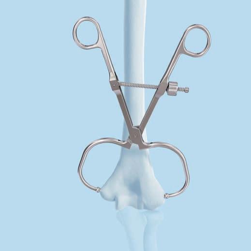 4 Reduce fracture and provide temporary fixation Instrument 03.118.001 Periarticular Reduction Forceps, with pointed ball tips B 6.