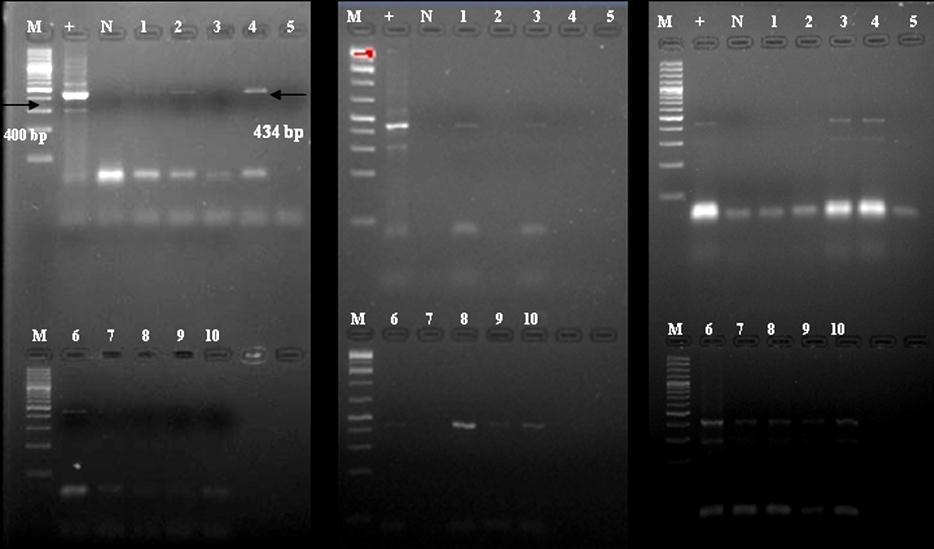 Fig.3 (A) LAMP amplified product of DNA samples from flock-3 (IBL-80 broilers), (B) LAMP products under UV transillumination and (C) Visual detection of LAMP products Lane M :100bp plus Molecular