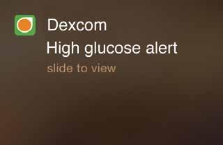 High Glucose Alert Example 1 A High Glucose Alert appears if your glucose rises above your High Alert setting.