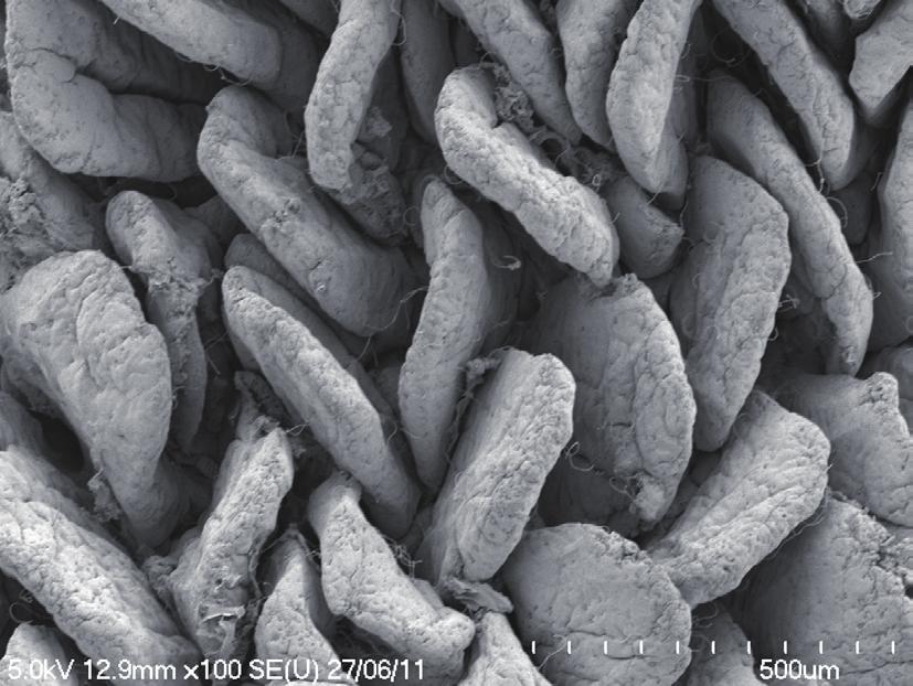 Figure 2: Electron micrograph of villi (left) and microvilli (right) of the small intestine.