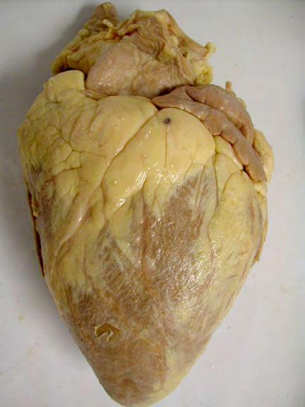 surface f the heart & the parietal pericardium cvering the inner surface f the parietal sac. These tw tissue layers are cntinuus with each ther where the vessels enter r leave the heart.