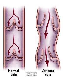 Venous System: Veins Veins are capacitance vessels (blood reservoirs) that contain 65% of the blood supply Veins have much lower blood pressure and thinner walls than arteries To return blood to the