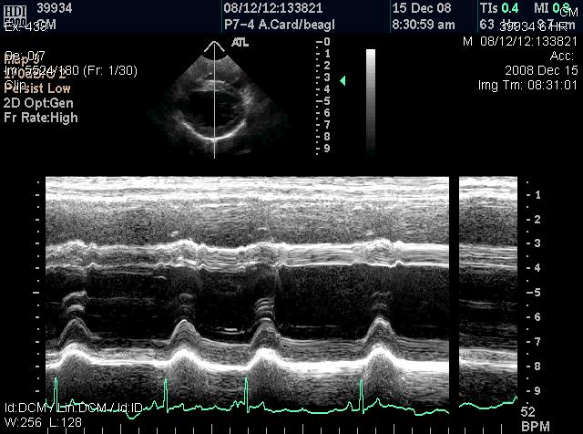 Dog Echo: Milrinone and Contractility Linear Regression of dp/dt+ vs Ejection Fraction