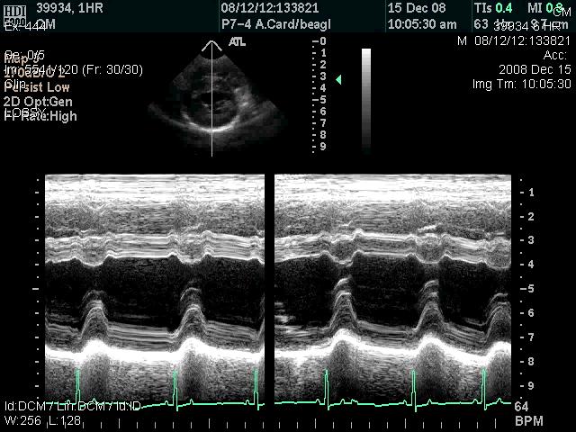 means EF Study by Terri S and Laura R Echo parameters can provide contractility data in