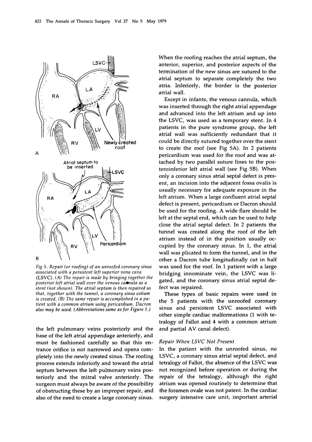 422 The Annals of Thoracic Surgery Vol 27 No 5 May 1979 B \ \ Atrial septum to Fig 5. Repair (or roofing) of an unroofed coronary sinus associated with a persistent left superior vena cava (LSVC).