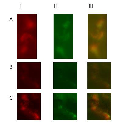 Figure 4. The images of these synapses from worm tissue were obtain from using a Photometrics CoolSNAP ES2 monochromatic camera and an inverted epifluorescence microscope.