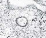 forming large vesicles called phagosomes (see Figure 5-20).