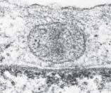 1 m in diameter. In one form of endocytosis, called pinocytosis, small droplets of extracellular fluid and any material dissolved in it are nonspecifically taken up.