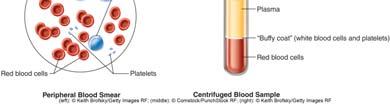45% is RBCs WBCs and platelets are <1% Percentage of RBCs is called the: Hematocrit (HCT) or Packed cell volume