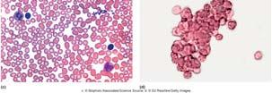 56 Compatible Blood Types for Transfusions Type 0 = Universal Donor: Type O lacks the A and B