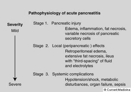 Pancreatitis Edema, congestion Advanced