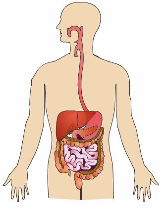 Colon Cancer Surgery Introduction Colon cancer is a life-threatening condition that affects thousands of people. Doctors usually recommend surgery for the removal of colon cancer.