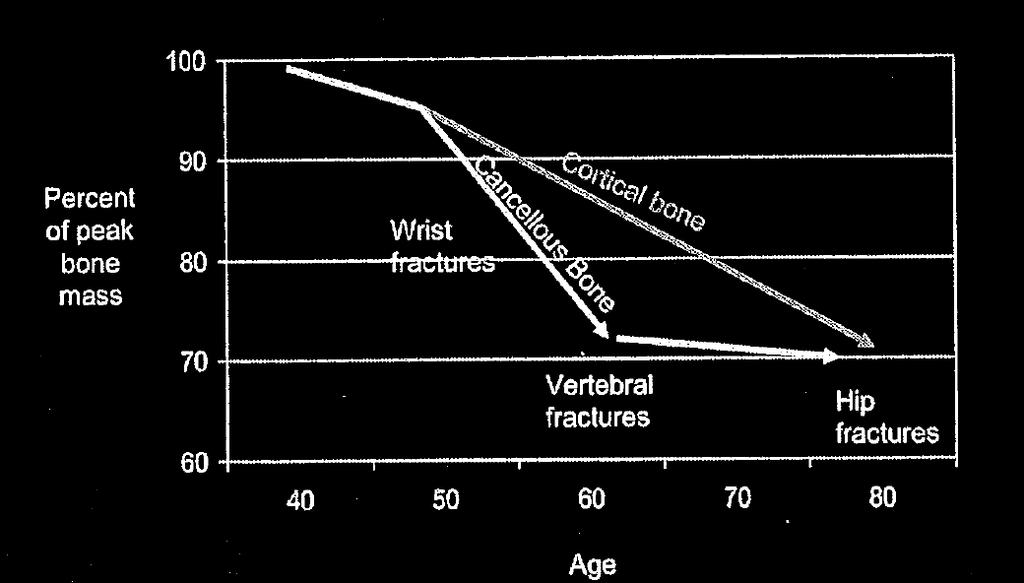 Bone Loss Wrist Vertebral Hip