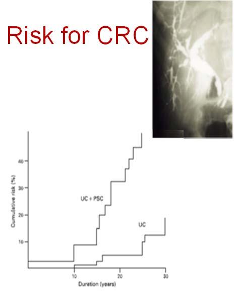 Concomitant Inflammatory Diseases: Primary Sclerosing Cholangitis Increases Risk for CRC 5% of extensive UC patients 5% neoplasia risk (p <0.