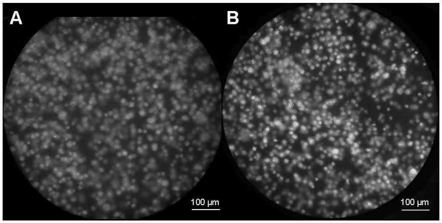 52 Figure 13. 1483 oral cancer cell images using proflavine as a contrast agent to visualize cell nuclei. (A) Image acquired with the SLR-based microendoscope.