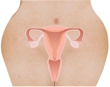 What is cervical cancer? Cancer can grow on a woman s cervix the same way it can grow on other body organs. The cervix is the opening of a woman s uterus (womb).
