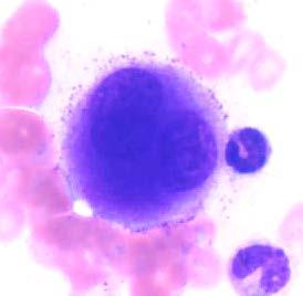 nuclei Differential count: Myeloids, 73.