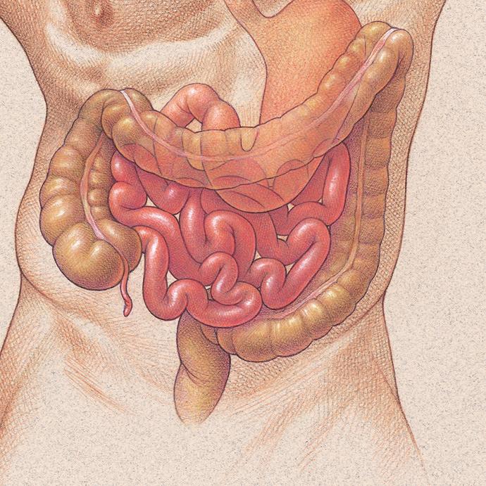 3 B A E D A: Ascending colon. B: Transverse colon. C: Descending colon. D: Sigmoid colon. E: Rectum. C What is a temporary loop ileostomy?