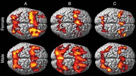 fmri studies have been used to point out differences in recovery time from MTBI between men and women.