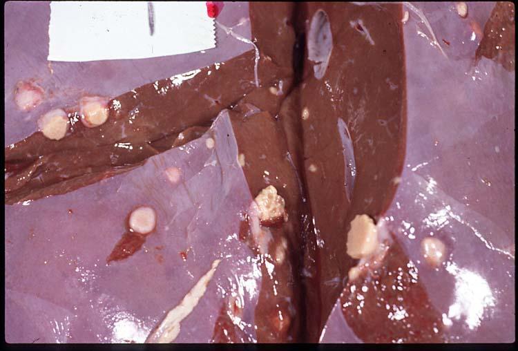 Morphologic diagnosis: Liver: Multifocal, acute, severe, necrotizing hepatitis This lesion in lambs is often associated with omphalophlebitis or