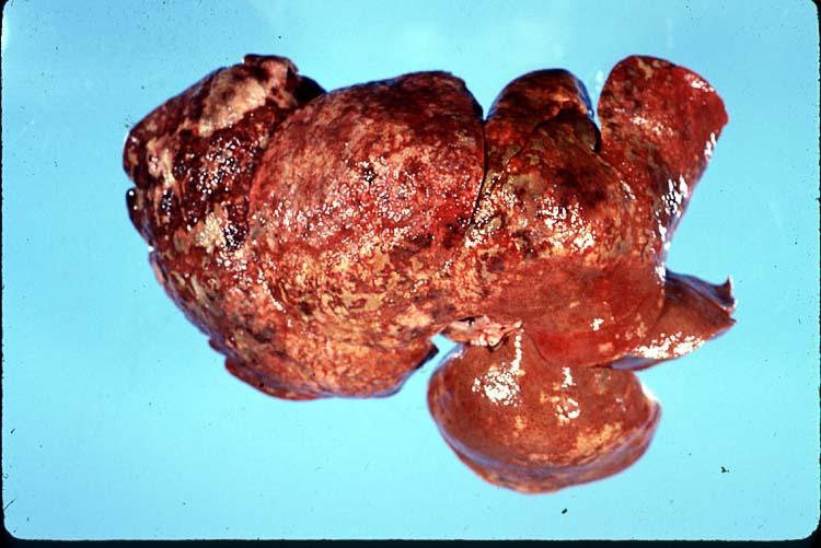 Case: F1285-90. Male, 18 year old domestic short hair cat. Describe the lesion: The left lobe of the liver is replaced by a large, multicystic, firm nodular mass (14 x 11 x 6cm).