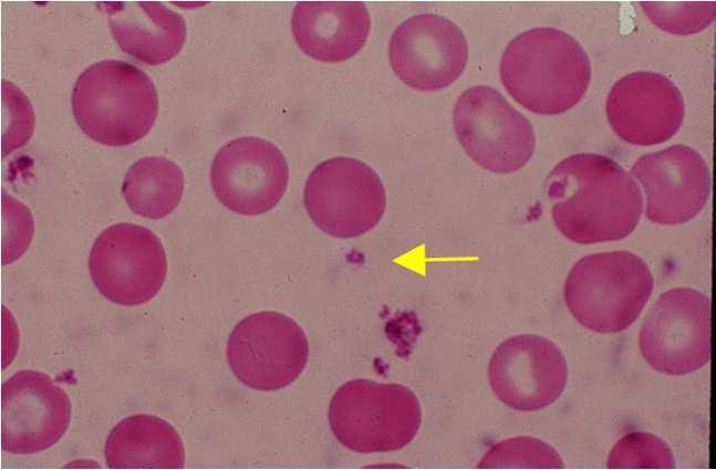 Platelet Physiology Thrombocytopenia produced in the bone marrow fragmentation of precursor megakaryocytes small colorless irregular shaped cell fragment with