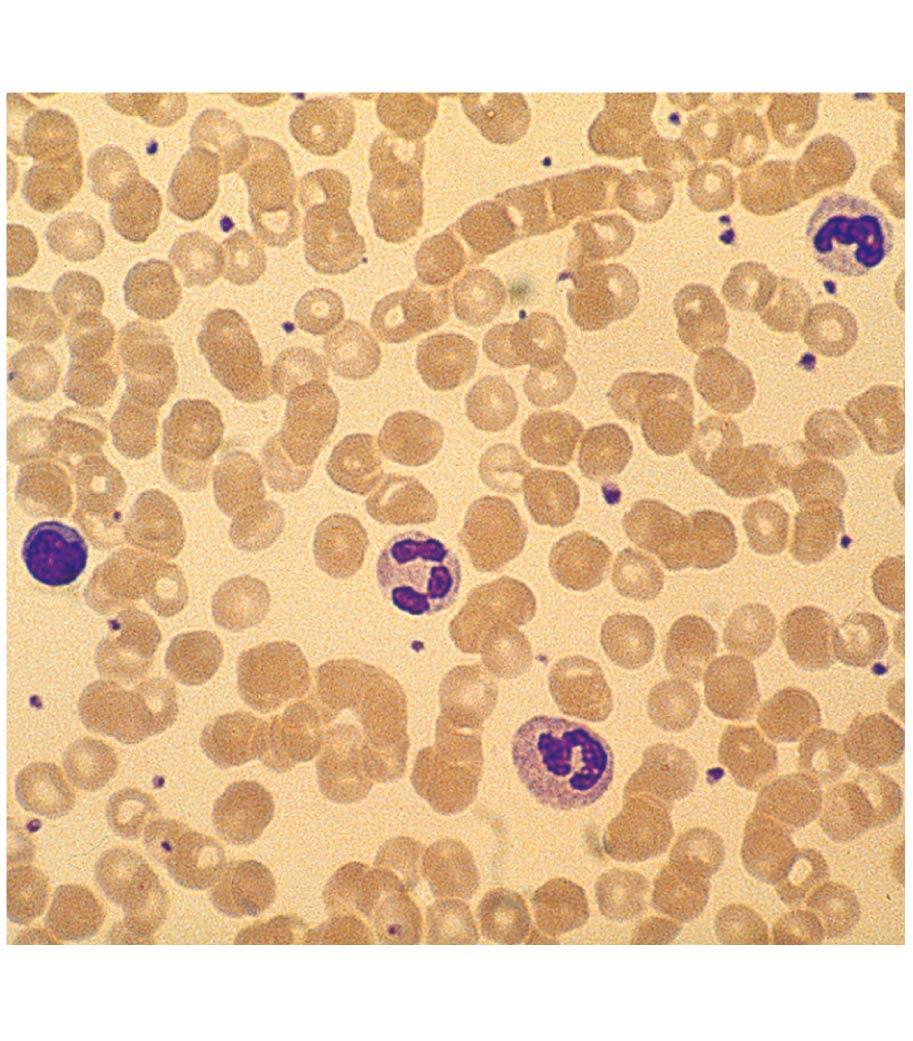 Formed Elements in Blood Erythrocytes Red blood cells (RBCs) Leukocytes White blood cells