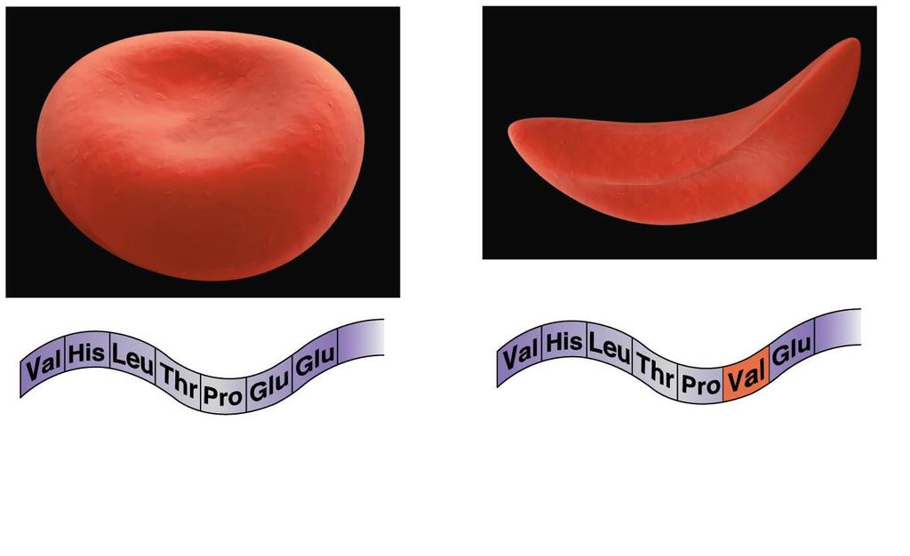 Red Blood Cells & Sickle Cell Anemia Sickle cell