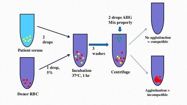 Blood Typing & Cross Matching Blood samples are mixed with anti-a and anti-b serum Agglutination or the lack of agglutination leads to identification