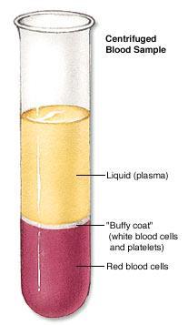 Centrifuged Blood Sample Plasma White