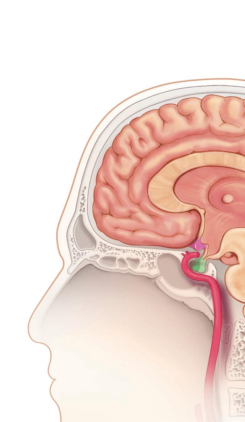 years Types of pituitary tumors 1,3,4 Pituitary tumors account for about 15% of intracranial neoplasms Four main pituitary tumors are related to: Pituitary