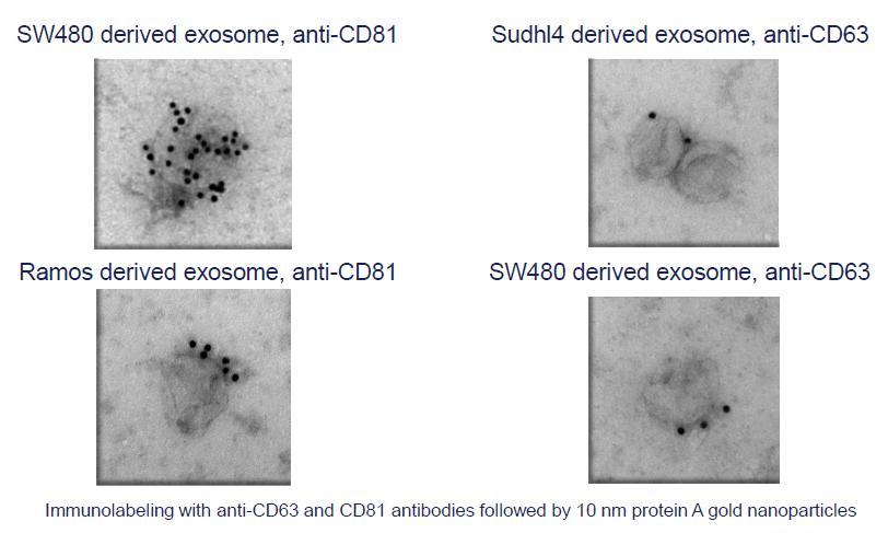 Analysis of Exosomes: