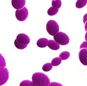 Streptococcus pneumoniae viruses Cytomegalovirus (CMV) Enterovirus Herpes