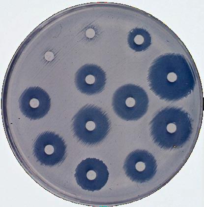 Enterobacter cloacae E.