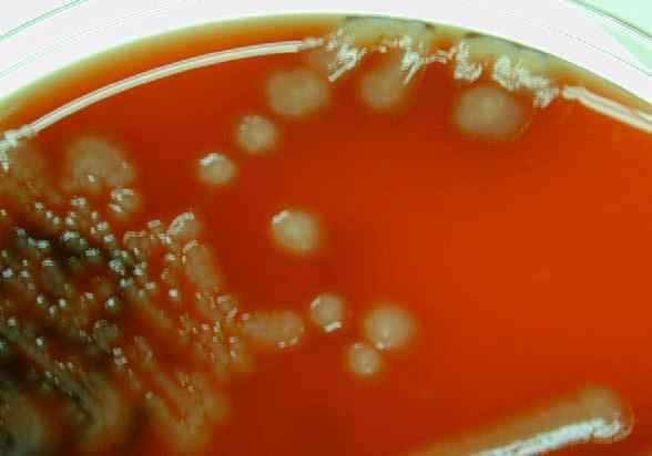 E. coli Gram