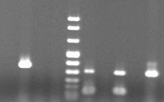 coli demonstrating high sensitivity and specificity in detecting DEC. PCR is a selective, sensitive, and specific assay.