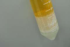 Add 250 ng cispermethrin (phenoxy 3 C 6 ) surrogate standard Add 5 ml %