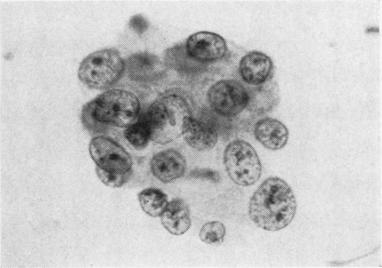 FIG. 10 FIG. 14 A pitfall in the cytodiagnosis of sputum of asthmatics FIG. 1 FIG.
