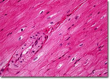 Smooth Muscle Tissue: in the