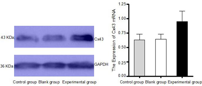 Cx43 gene and NCI-H226 13115 Cx43 protein expression The western blot analysis revealed significantly wider bands in the experimental NCI-H226/pbudCE4.